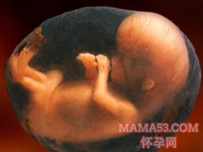 胎儿缺氧孕妇有什么反应